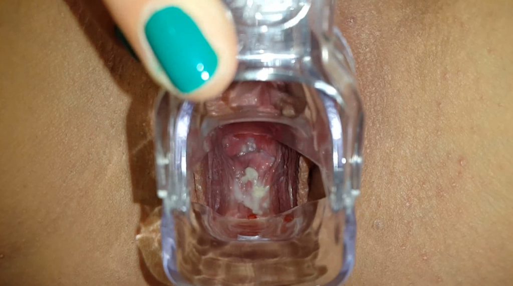 Through The Speculum – Anna Coprofield - 2